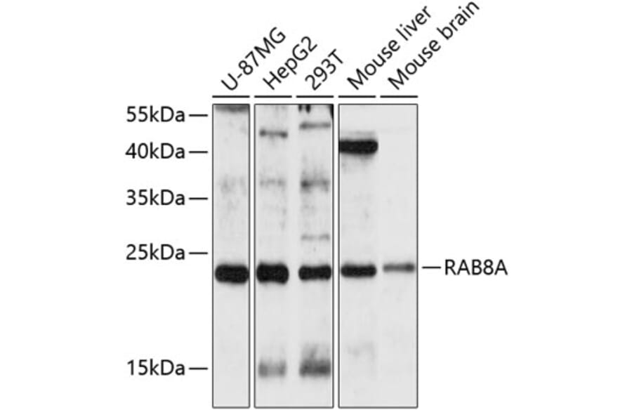 Western Blot - Anti-RAB8A Antibody (A3615) - Antibodies.com
