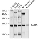 Western Blot - Anti-RAB8A Antibody (A3615) - Antibodies.com