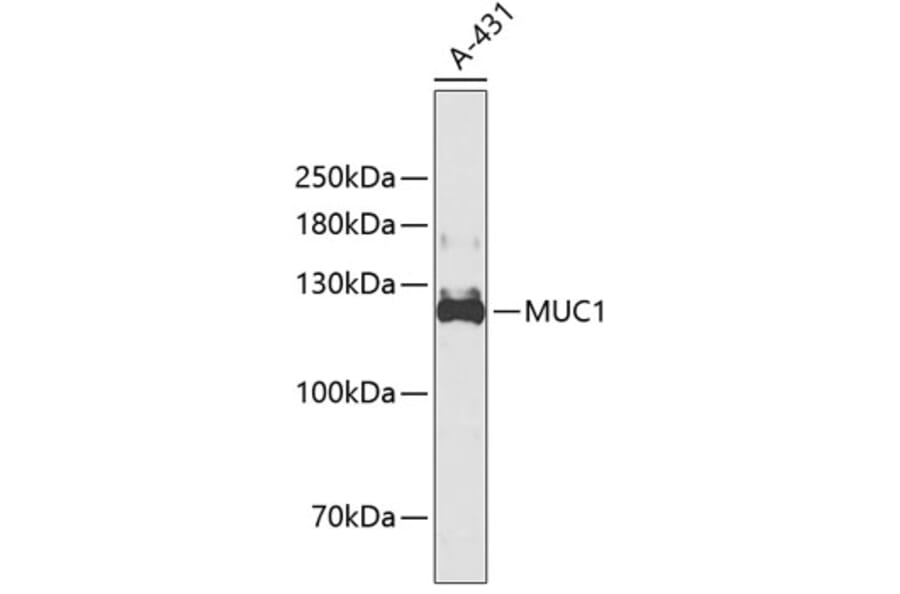 Western Blot - Anti-MUC1 Antibody (A3619) - Antibodies.com