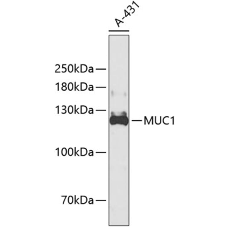 Western Blot - Anti-MUC1 Antibody (A3619) - Antibodies.com
