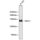 Western Blot - Anti-MUC1 Antibody (A3619) - Antibodies.com