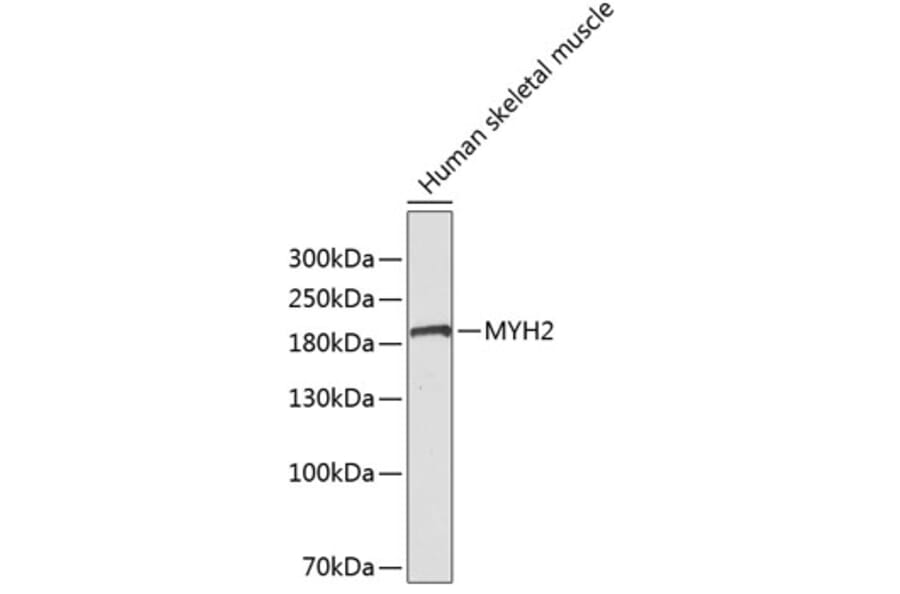 Western Blot - Anti-MYH2 Antibody (A3620) - Antibodies.com