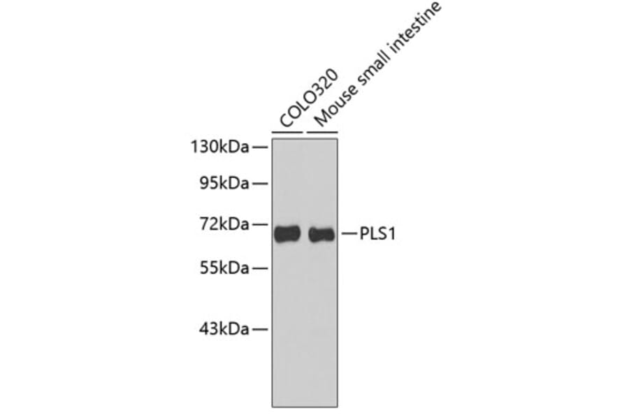 Western Blot - Anti-PLS1 Antibody (A3626) - Antibodies.com