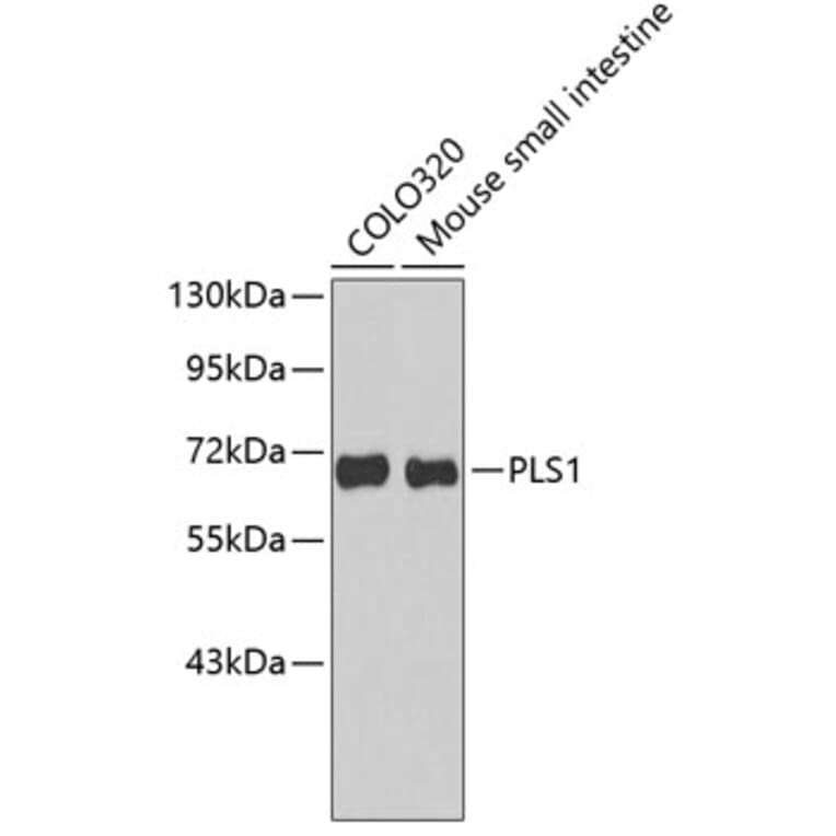 Western Blot - Anti-PLS1 Antibody (A3626) - Antibodies.com