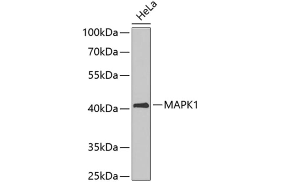 Western Blot - Anti-MAPK1 Antibody (A3630) - Antibodies.com