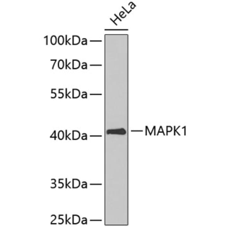 Western Blot - Anti-MAPK1 Antibody (A3630) - Antibodies.com