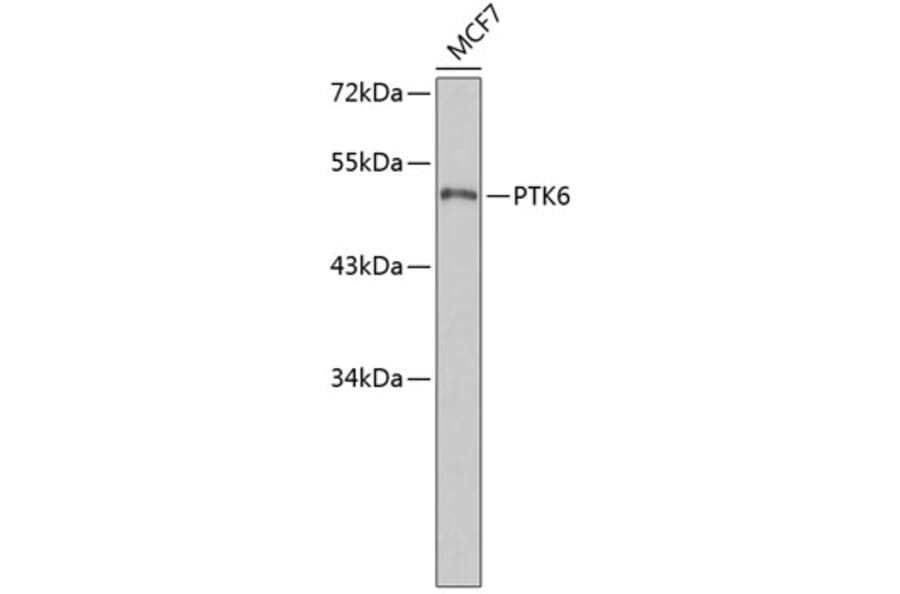 Western Blot - Anti-PTK6 Antibody (A3632) - Antibodies.com