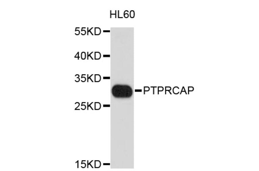 Western Blot - Anti-PTPRCAP Antibody (A3633) - Antibodies.com