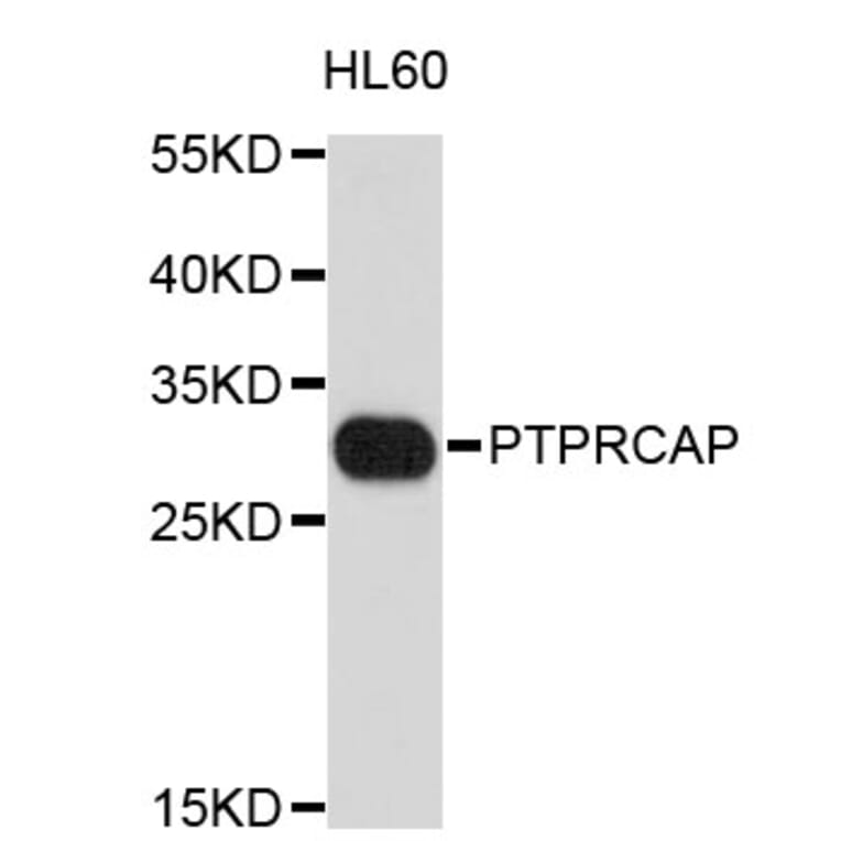 Western Blot - Anti-PTPRCAP Antibody (A3633) - Antibodies.com