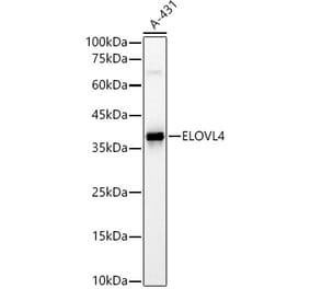 Western Blot - Anti-ELOVL4 Antibody (A9253) - Antibodies.com