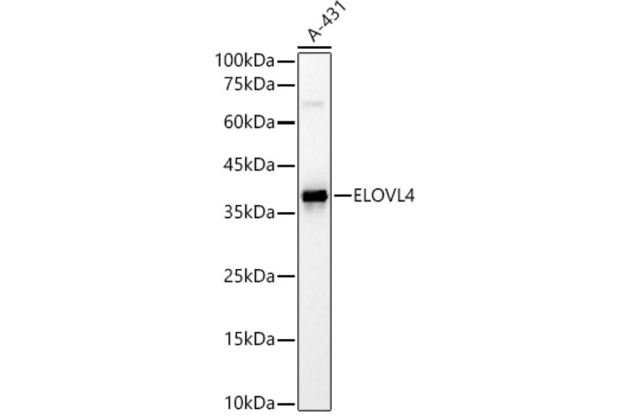 Western Blot - Anti-ELOVL4 Antibody (A9253) - Antibodies.com