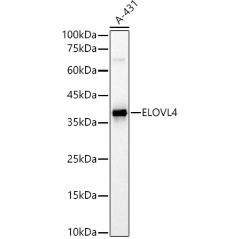 Western Blot - Anti-ELOVL4 Antibody (A9253) - Antibodies.com