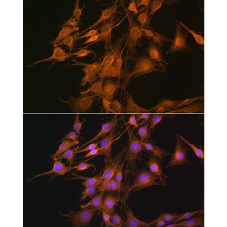 Immunofluorescence - Anti-ELOVL4 Antibody (A9253) - Antibodies.com