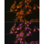 Immunofluorescence - Anti-ELOVL4 Antibody (A9253) - Antibodies.com