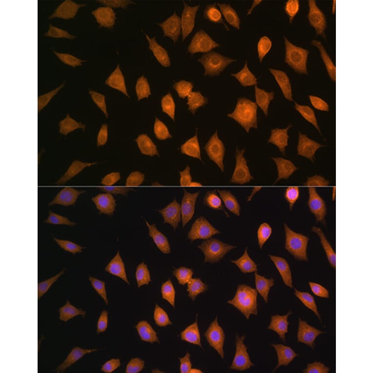 Immunofluorescence - Anti-ELOVL4 Antibody (A9253) - Antibodies.com