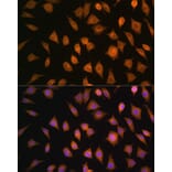 Immunofluorescence - Anti-ELOVL4 Antibody (A9253) - Antibodies.com