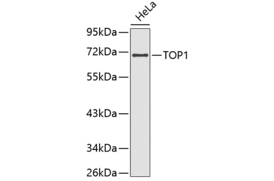 Western Blot - Anti-TOP1 Antibody (A3643) - Antibodies.com