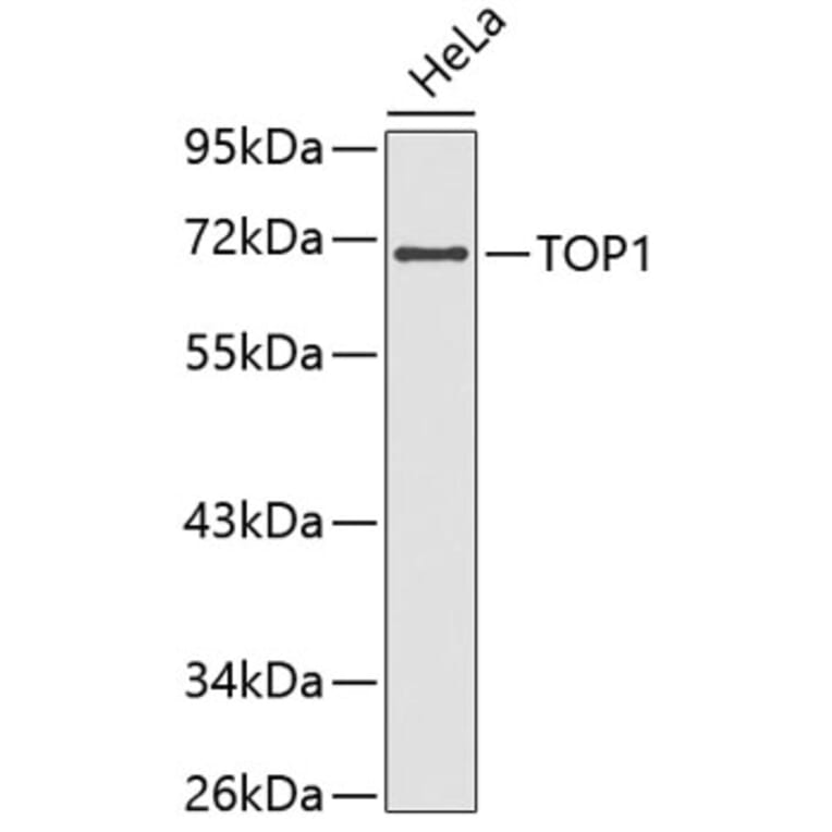 Western Blot - Anti-TOP1 Antibody (A3643) - Antibodies.com
