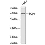 Western Blot - Anti-TOP1 Antibody (A3643) - Antibodies.com
