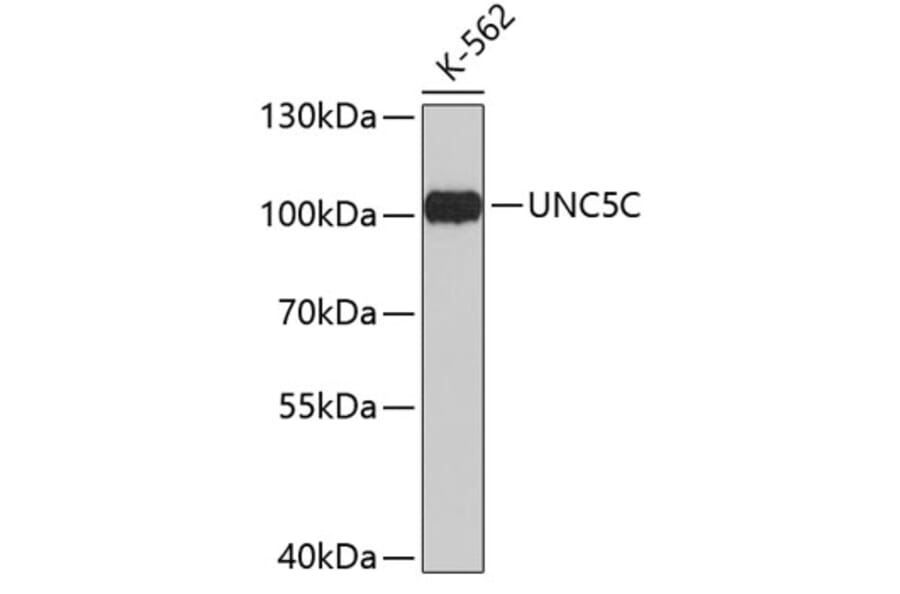 Western Blot - Anti-UNC5C Antibody (A3651) - Antibodies.com