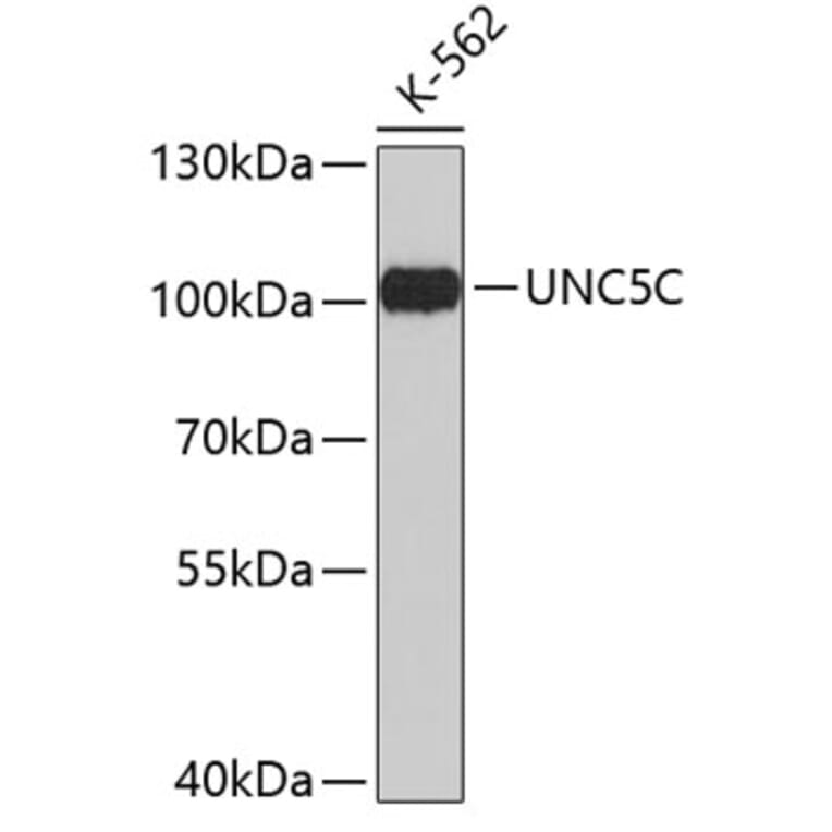 Western Blot - Anti-UNC5C Antibody (A3651) - Antibodies.com