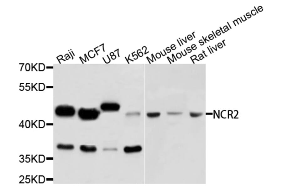 Western Blot - Anti-NCR2 Antibody (A3657) - Antibodies.com