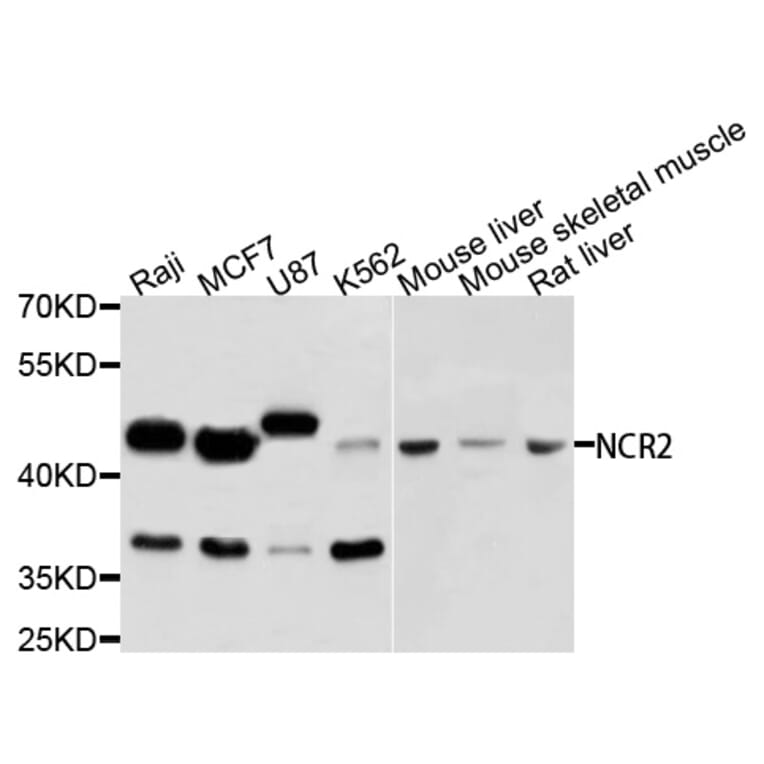Western Blot - Anti-NCR2 Antibody (A3657) - Antibodies.com