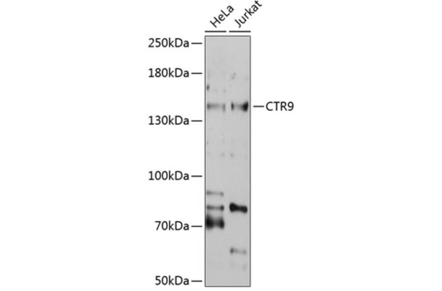 Western Blot - Anti-CTR9 Antibody (A3659) - Antibodies.com