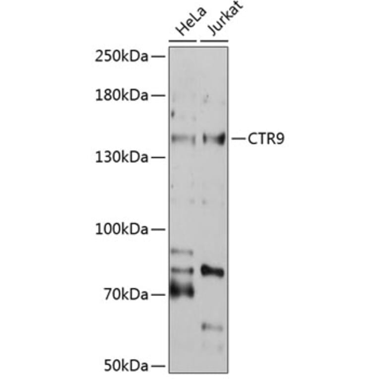Western Blot - Anti-CTR9 Antibody (A3659) - Antibodies.com
