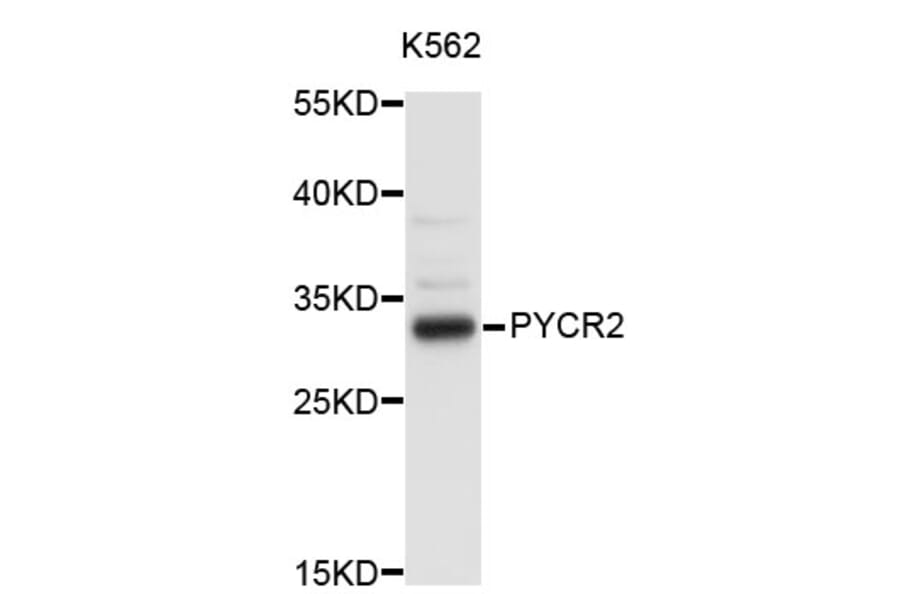 Western Blot - Anti-PYCR2 Antibody (A3676) - Antibodies.com