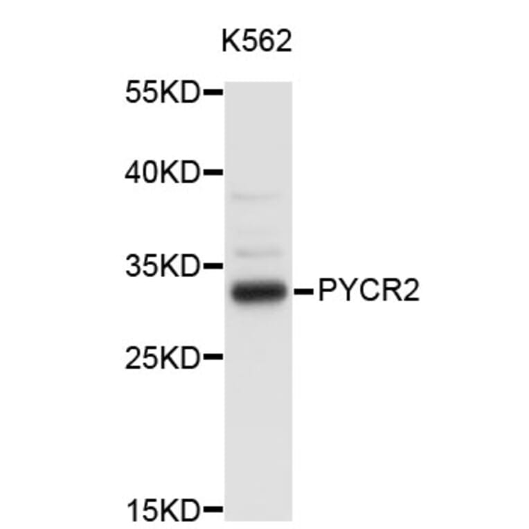 Western Blot - Anti-PYCR2 Antibody (A3676) - Antibodies.com