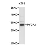 Western Blot - Anti-PYCR2 Antibody (A3676) - Antibodies.com
