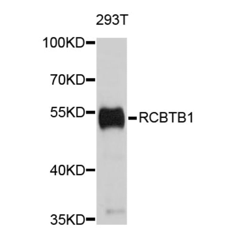 Western Blot - Anti-RCBTB1 Antibody (A3681) - Antibodies.com