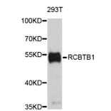 Western Blot - Anti-RCBTB1 Antibody (A3681) - Antibodies.com