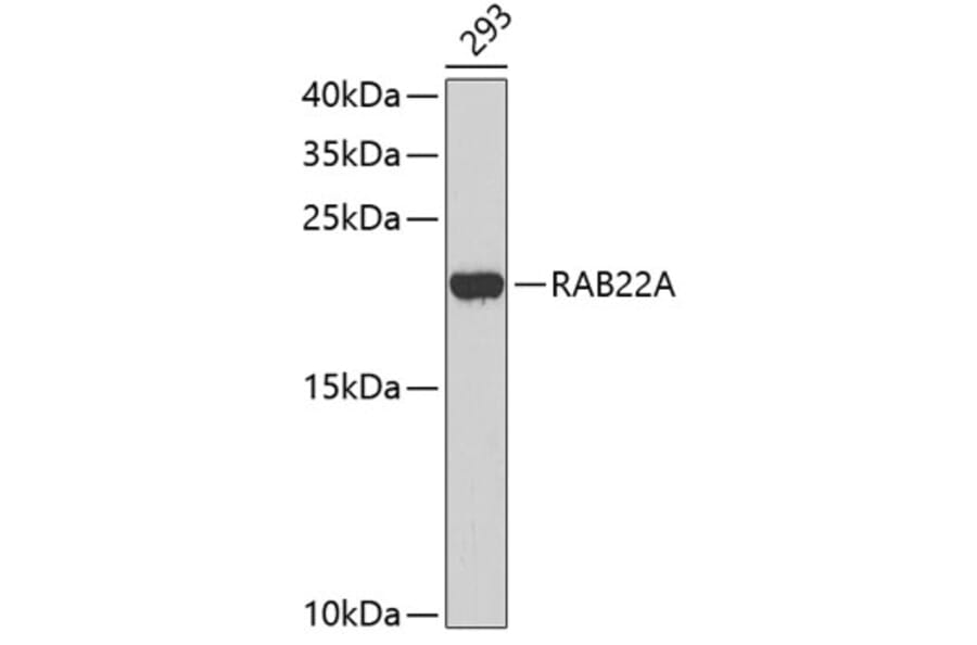 Western Blot - Anti-RAB22A Antibody (A3685) - Antibodies.com