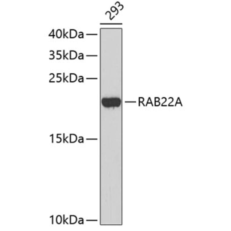 Western Blot - Anti-RAB22A Antibody (A3685) - Antibodies.com