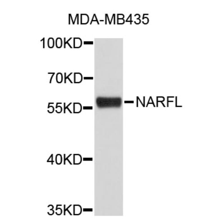 Western Blot - Anti-NARFL Antibody (A3688) - Antibodies.com