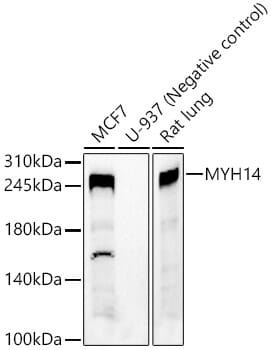 Western blot analysis of extracts of various cell lines, using Anti-MYH14 Antibody (A3690) at 1:1,000 dilution.
Secondary antibody: Goat Anti-Rabbit IgG (H+L) (HRP) (AS014) at 1:10,000 dilution.
Lysates / proteins: 25µg per lane.
Blocking buffer: 3% non-fat dry milk in TBST.
Detection: ECL Basic Kit (RM00020).
Exposure time: 1s.
