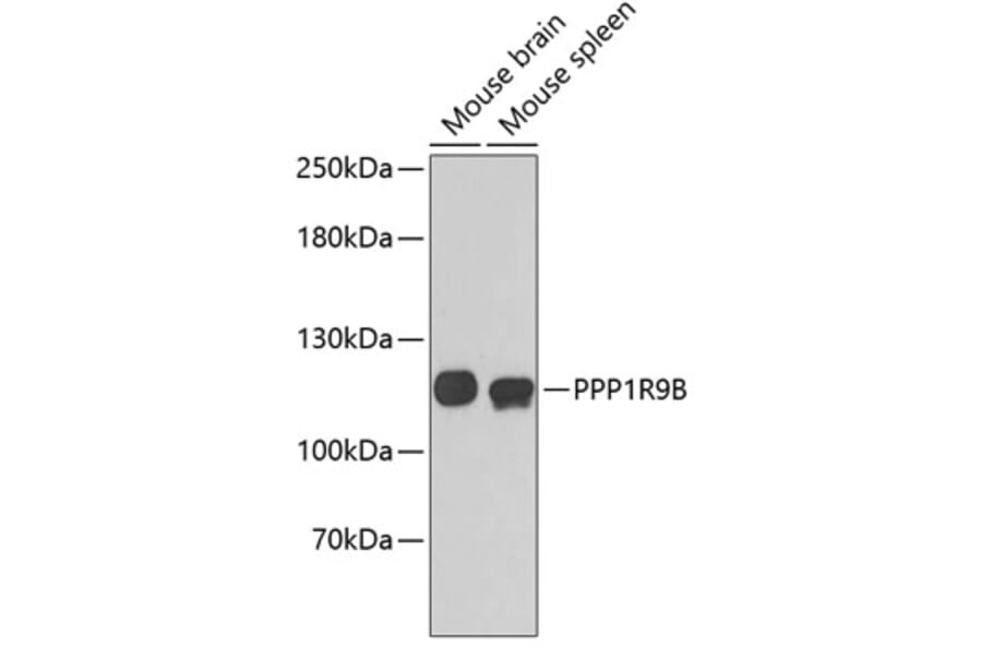 Western Blot - Anti-PPP1R9B Antibody (A3693) - Antibodies.com
