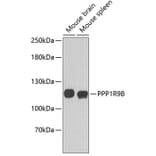 Western Blot - Anti-PPP1R9B Antibody (A3693) - Antibodies.com