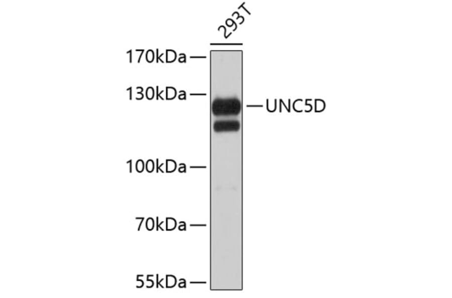 Western Blot - Anti-UNC5D Antibody (A3704) - Antibodies.com