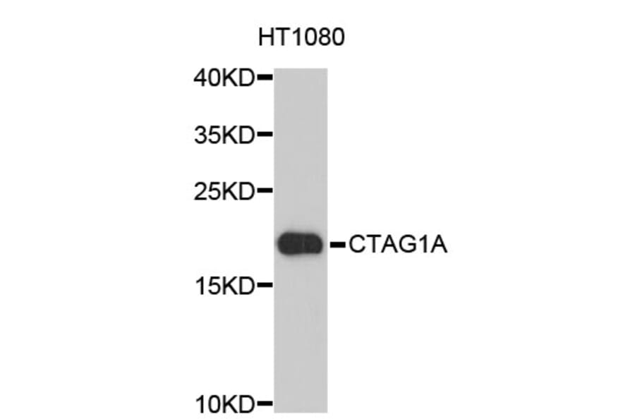 Western Blot - Anti-CTAG1A Antibody (A3709) - Antibodies.com