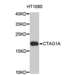 Western Blot - Anti-CTAG1A Antibody (A3709) - Antibodies.com