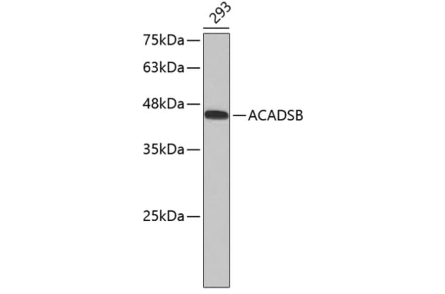 Western Blot - Anti-ACADSB Antibody (A3715) - Antibodies.com