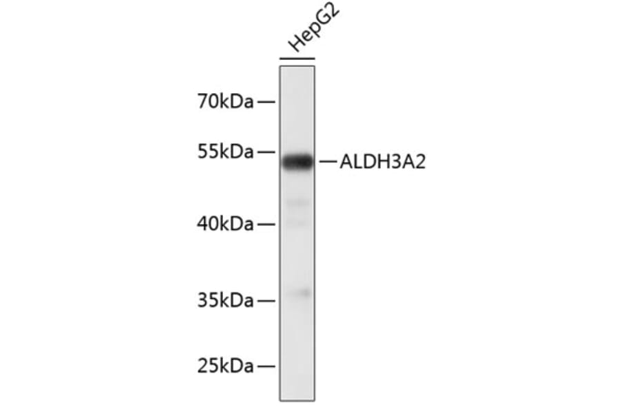 Western Blot - Anti-ALDH3A2 Antibody (A3727) - Antibodies.com