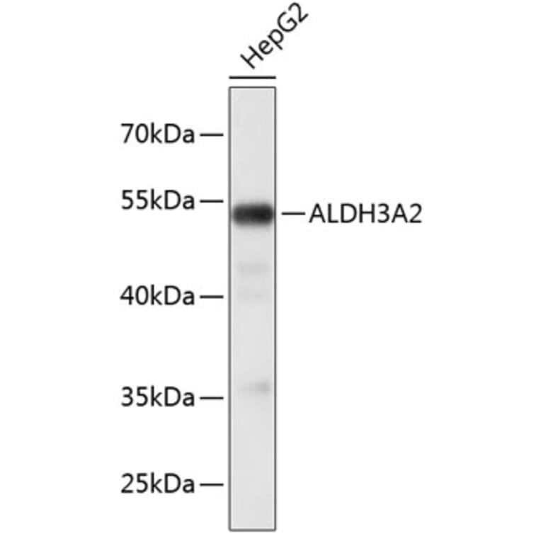 Western Blot - Anti-ALDH3A2 Antibody (A3727) - Antibodies.com
