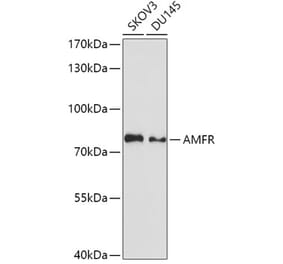Western Blot - Anti-gp78 Antibody (A9274) - Antibodies.com