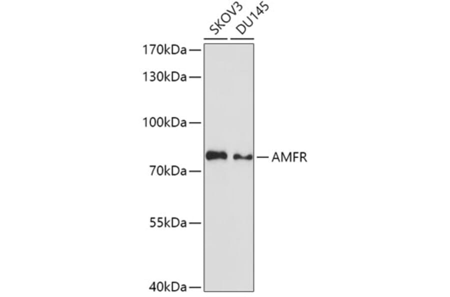 Western Blot - Anti-gp78 Antibody (A9274) - Antibodies.com