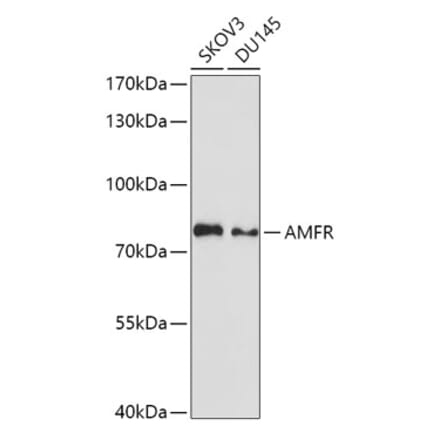 Western Blot - Anti-gp78 Antibody (A9274) - Antibodies.com