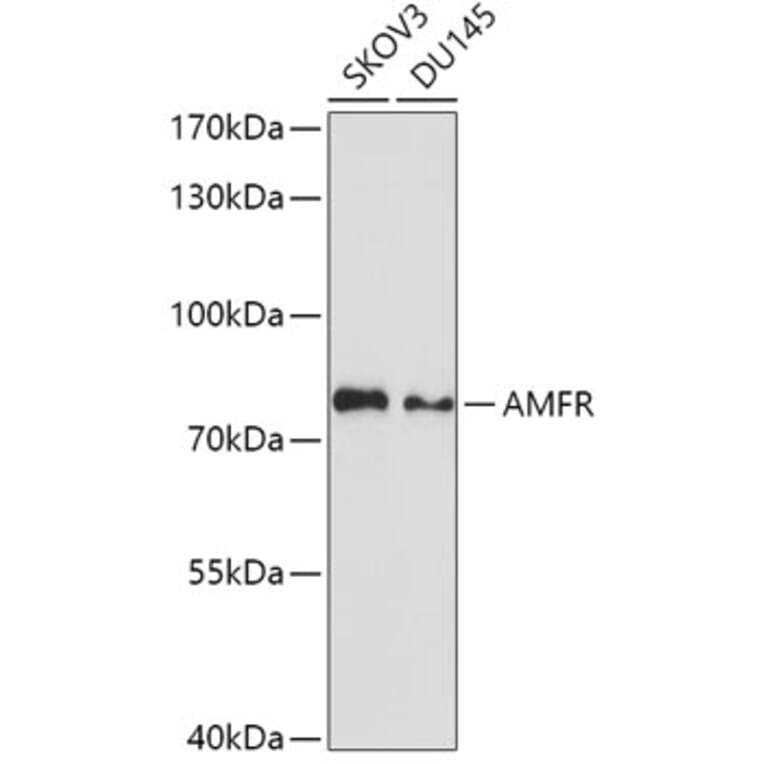 Western Blot - Anti-gp78 Antibody (A9274) - Antibodies.com